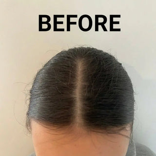 Back of a person's head with 'BEFORE' text, showing hair texture and scalp.